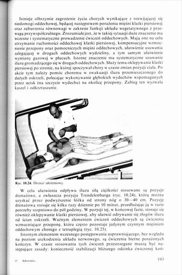 Schorzenia i urazy kręgosłupa, Kiwerski 1997 - 0000190.jpg